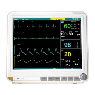 Elettrocardiogramma Sangue Saturazione di ossigeno Temperatura corporea Monitor medici