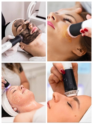 3 in 1 Peeling a getto di ossigeno Infusione Facelifting Cosmetico Stringing Beauty Skin Care CO2 Bubble Oxygenation Exfoliate Oxygen Facial Machine