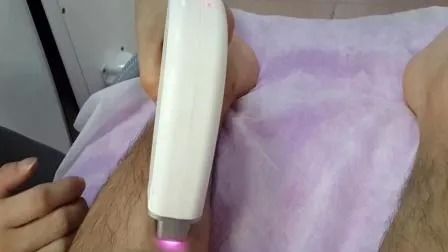 Prezzo competitivo 808nm diodo laser depilazione macchina con energia 1-50A e 1-400ms larghezza di impulso per l'uso in salone